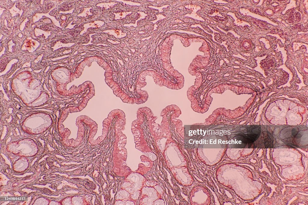 URETHRA in the human PENIS--also shows URETHRAL GLANDS and ERECTILE TISSUE, 25X