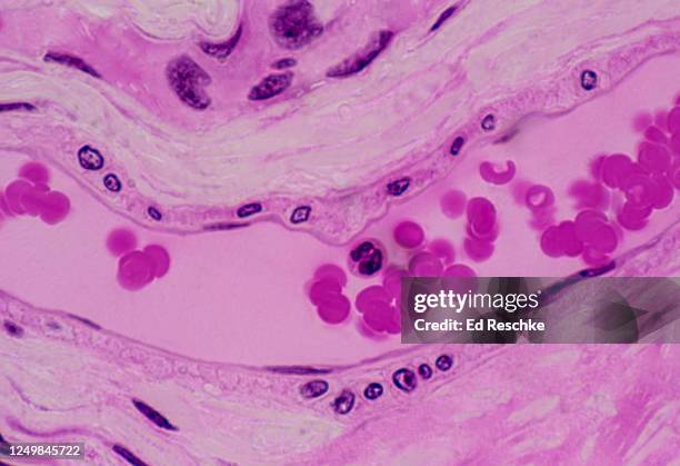 venule with red blood cells and one white blood cell and endothelium, 25x - venula foto e immagini stock