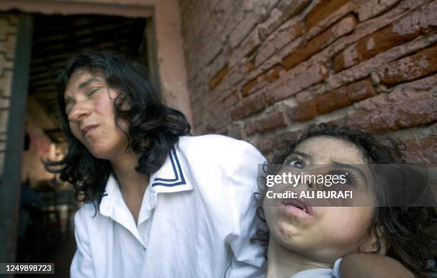 María Aguilar is seen holding her nine year old daughter Rocío who suffers from malnutrition in Corrientes, Argentina 14 August 2002. ACOMPAÑA...