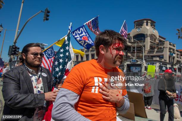 Man was hit in the head with a skateboard at Pro-Trump rally near pier along Pacific Coast Highway on Saturday, April 1, 2023 in Huntington Beach, CA.