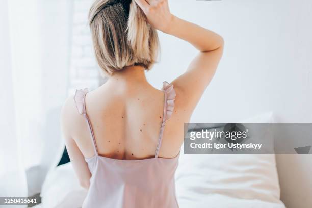 rear view of young blond woman making hairstyle - mole stock pictures, royalty-free photos & images