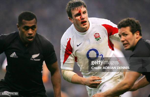 England's bloodied Captain Martin Corry runs through the New Zealand defensive line during the Investec Challenge rugby union international match at...