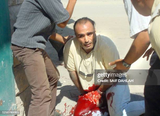 Imad Abu Zahra, a freelance writer and photographer for a Palestinian publication, holds his bleeding leg when Israeli forces opened fire after a...