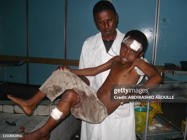 Somali boy injured following an overnight mortar attack on his family's residence in Mogadishu is attended to at the Medina hospital July 2, 2008 in...