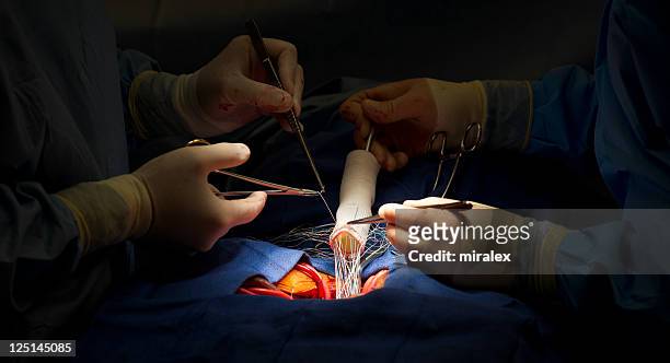 heart surgery aortic valve and ascending aorta replacement - blood system stock pictures, royalty-free photos & images