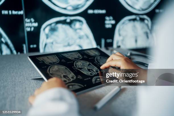 imagen del examen de tc de doctor looking en computer monitor - radiologist fotografías e imágenes de stock