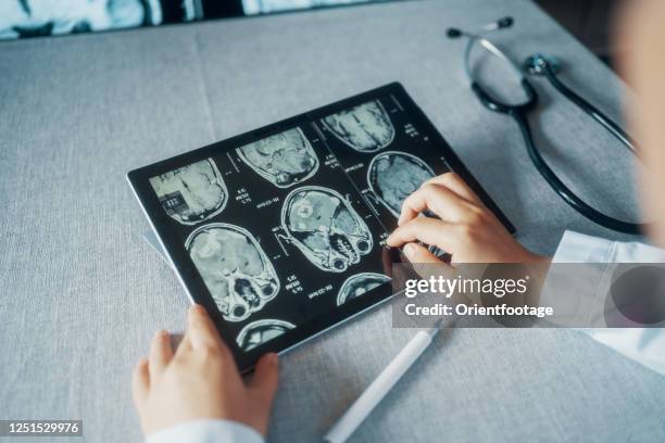 doctor looking ct examination image at computer monitor - flexible screen stock pictures, royalty-free photos & images