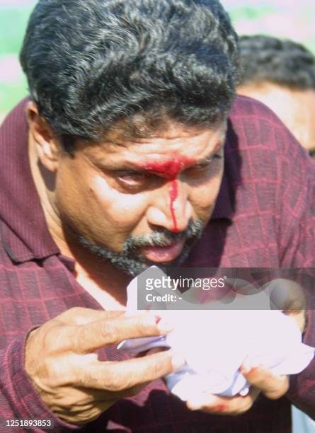 Wisden Indian cricketer of the century Kapil Dev wipes his bleeding brow fater being hit in the head by a golf ball at the Chandigarh Golf Academy in...
