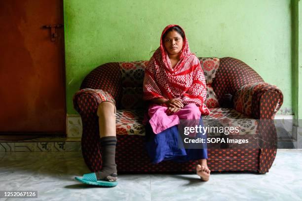 Rana Plaza collapse survivor Sumi Akhter poses for a portrait with her prosthetic leg at her residence. She lost her leg when Rana Plaza collapsed in...