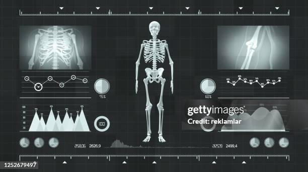 ilustrações, clipart, desenhos animados e ícones de visão de interface futurista com a parte superior holográfica do corpo humano com hud, interface médica futurista anatomia humana, ilustração criativa de anatomia, hud o fundo mundial de tecnologia cibernética de dados digitais. - osteoporose