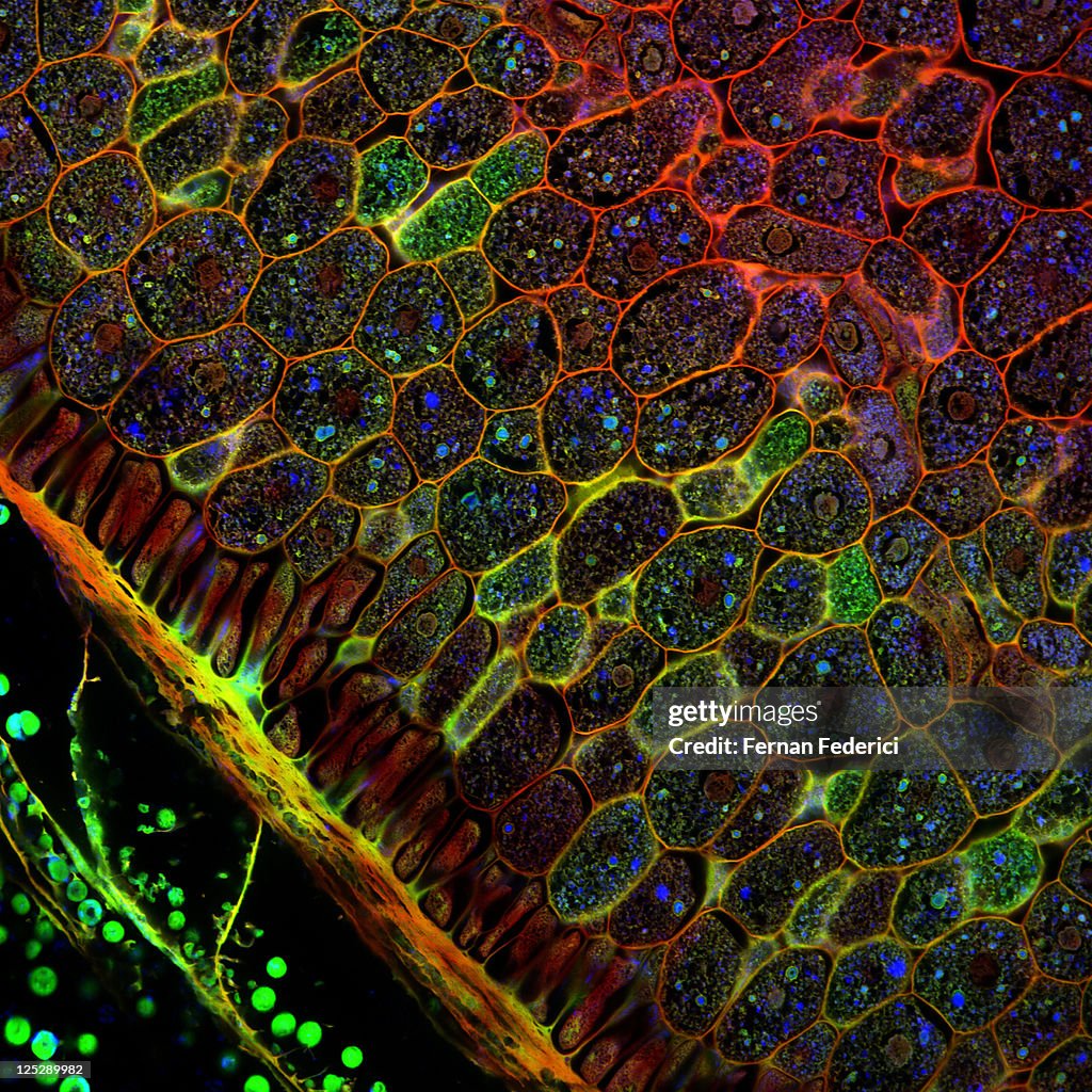 Confocal microscopy of plant tissues