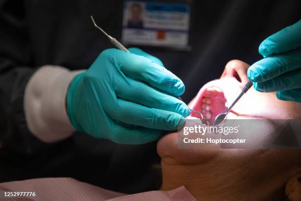 een tandarts het dragen van chirurgische handschoenen maakt gebruik van een loupe licht om de tanden van een vrouwelijke patiënt te onderzoeken in haar jaren zestig in een tandheelkundige kliniek - dental filling stockfoto's en -beelden