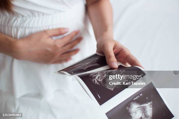 a pregnant woman is holding an ultrasound scan result - ultrasound stockfoto's en -beelden