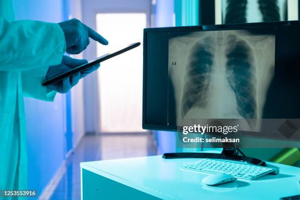 Chest X Ray Computer Chest Xray Screen Photos and Premium High Res Pictures - Getty Images