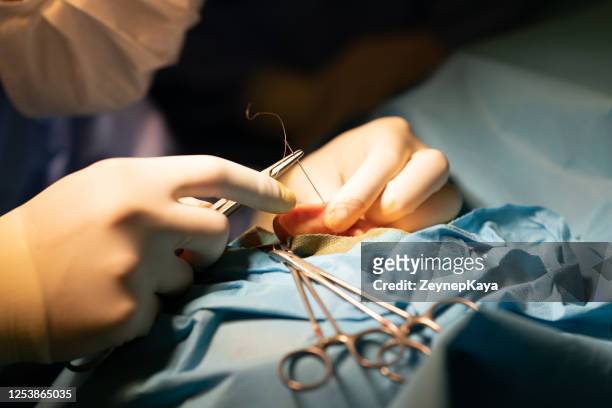 close-up do cirurgião fazendo pontos durante a cirurgia - suturar - fotografias e filmes do acervo