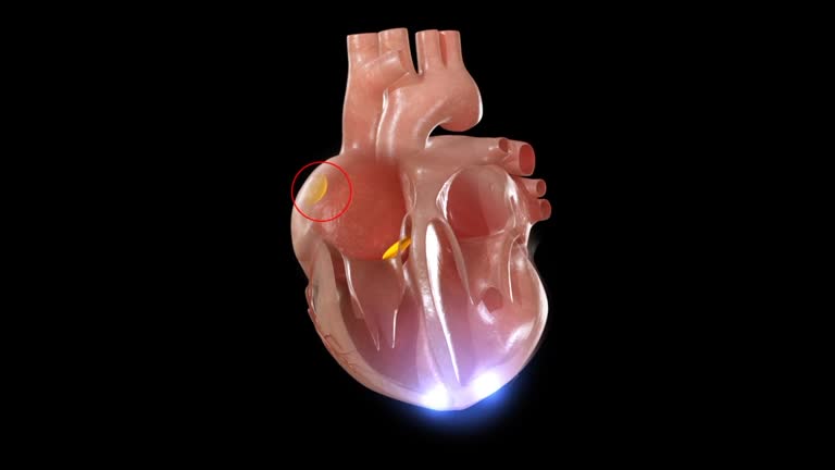 7,277 Human Heart Videos and HD Footage - Getty Images 7,277 Human Heart Videos and HD Footage - Getty Images