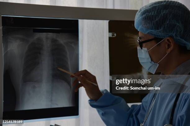 the doctor is watching image of x-ray film  of patient for a physical examination anatomy - film screening - fotografias e filmes do acervo