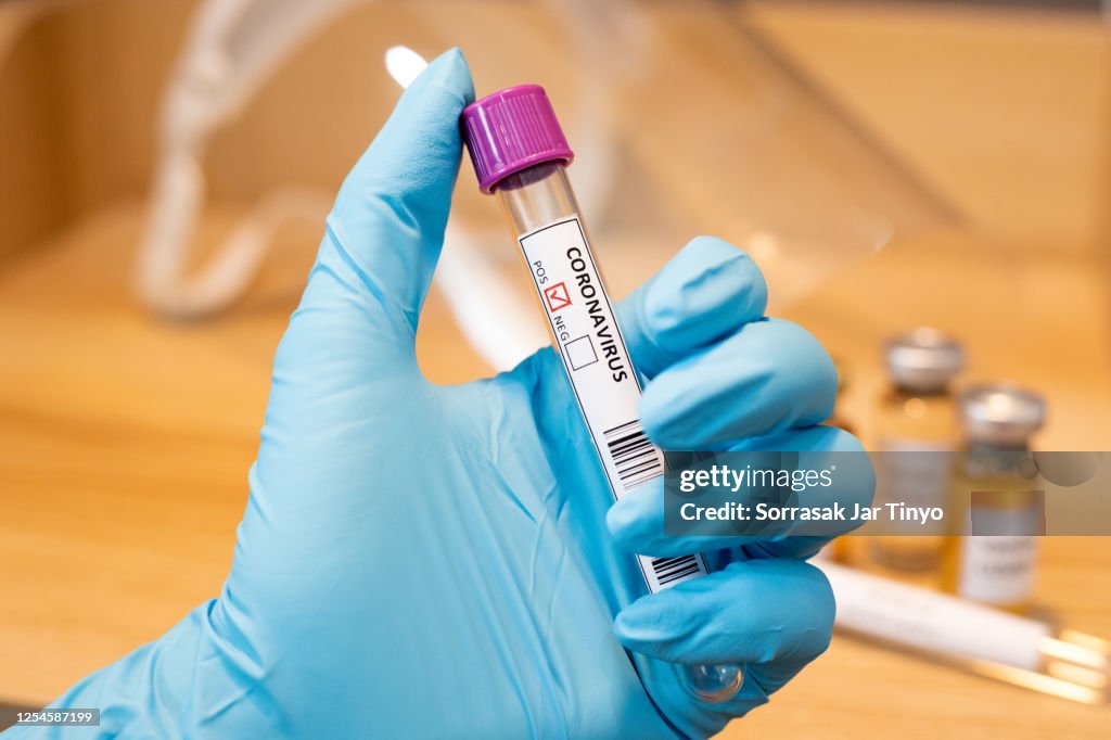 Sample Yuve Corona Virus Blood Sample Test Tube High-Res Stock Photo - Getty Images