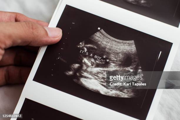 a young person is holding an ultrasound scan test result with "baby boy" written on it - prenatal care stock pictures, royalty-free photos & images
