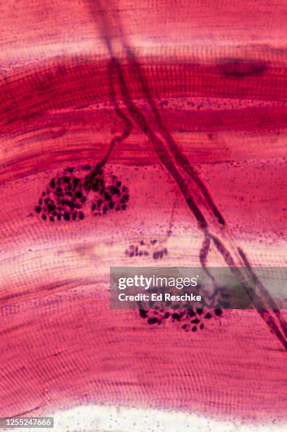 motor neurons innervating skeletal muscle cells (fibers) and neuromuscular junctions, 160x - acetylcholine stock pictures, royalty-free photos & images