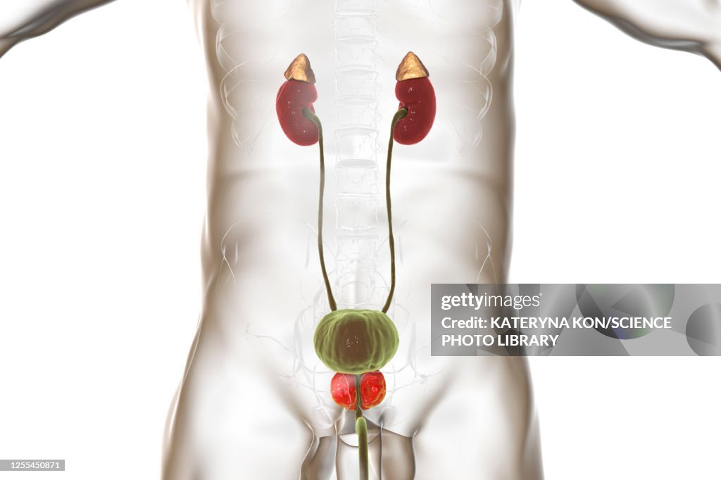 Benign prostatic hyperplasia, illustration