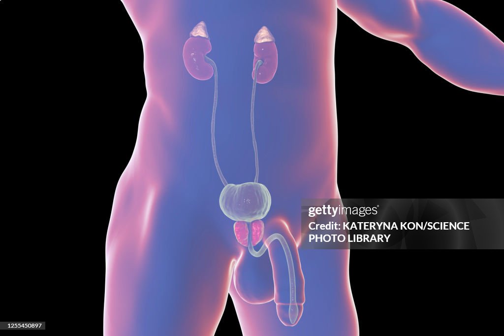 Benign prostatic hyperplasia, illustration