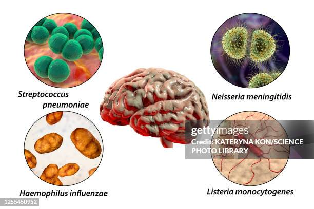 illustrations, cliparts, dessins animés et icônes de causes of bacterial meningitis, illustration - commensalisme