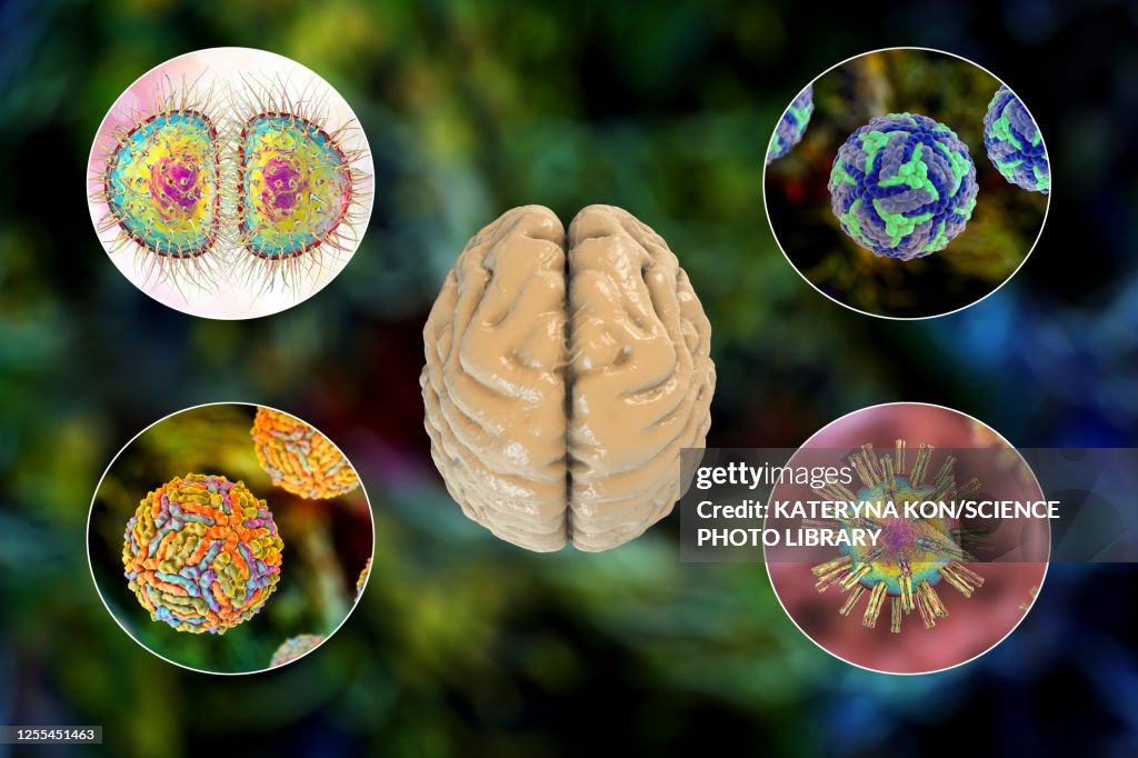 Neurodevelopment Brain Infection Brain Infections Illustration Ilustración de stock - Getty Images