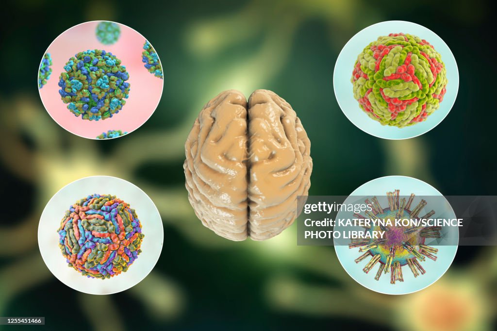 Brain Infections Illustration High-Res Vector Graphic - Getty Images