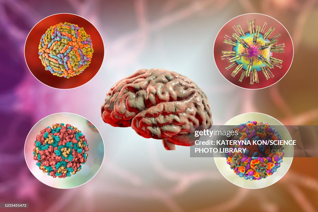 Creier Infectat Brain Infections Illustration High-Res Vector Graphic - Getty Images