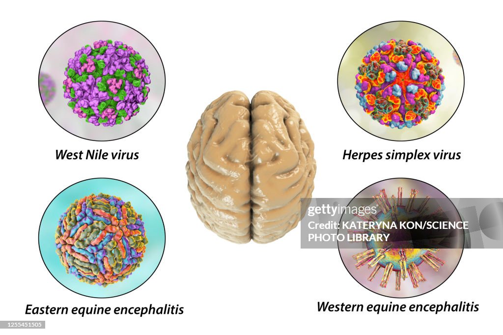 Creier Infectat Brain Infections Illustration High-Res Vector Graphic - Getty Images
