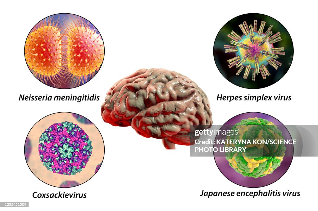 Creier Infectat Brain Infections Illustration High-Res Vector Graphic - Getty Images