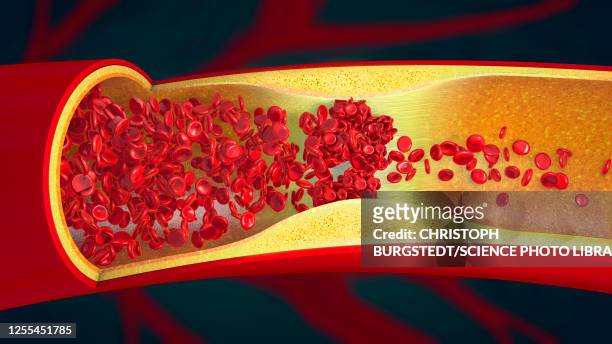 blood clot, illustration - blood clot stock illustrations