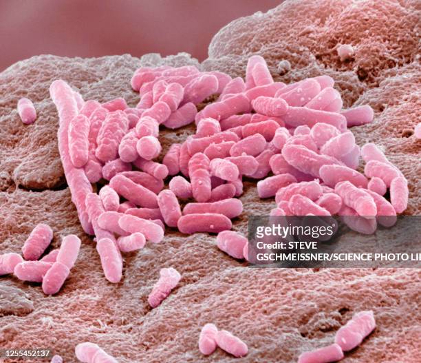 e coli, sem - 大腸菌 ストックフォトと画像