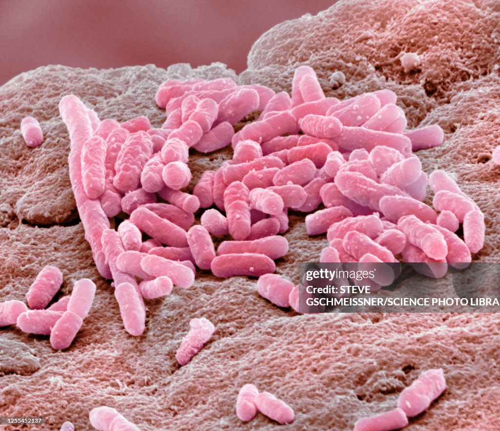 E Coli, SEM