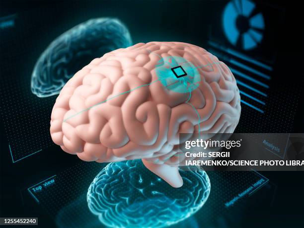 chip implanted in human brain, illustration - brain intelligence stock illustrations