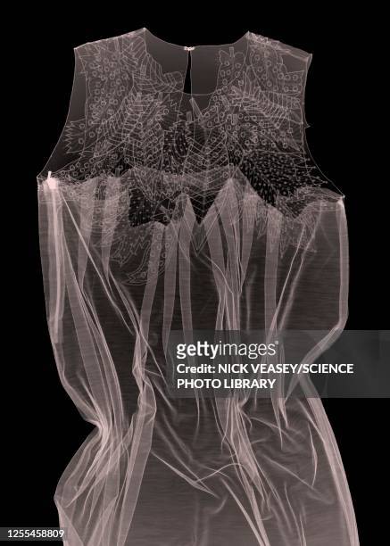 dress, x-ray - lace dress stock pictures, royalty-free photos & images