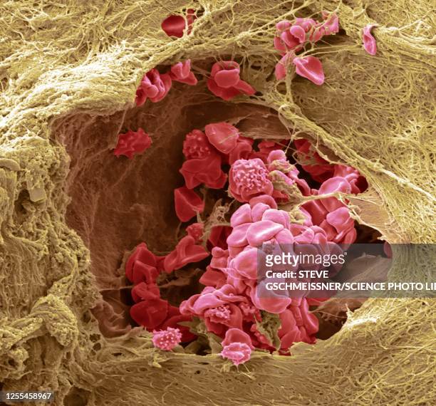 skin blood vessel, sem - human skin close up stock illustrations