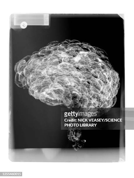 mammal brain on film, x-ray - radiogram photographic image fotografías e imágenes de stock