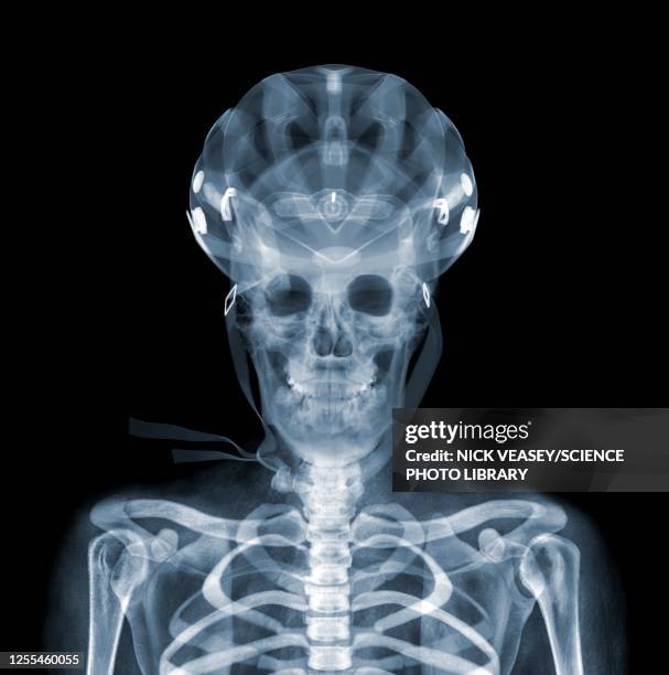 bicycle helmet and rider, x-ray - skull helmet stock pictures, royalty-free photos & images