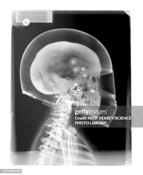 skull and helmet, x-ray - skull helmet stock pictures, royalty-free photos & images