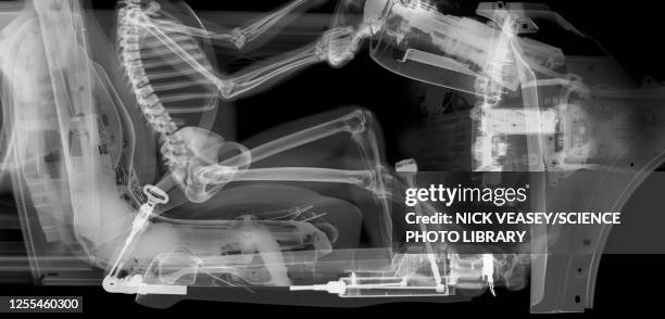 skeleton driver in car, x-ray - femur stock pictures, royalty-free photos & images