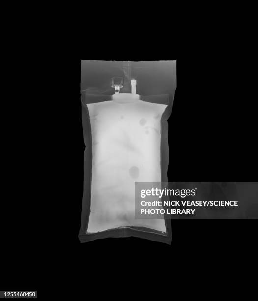 saline bag, x-ray - flebo salina foto e immagini stock