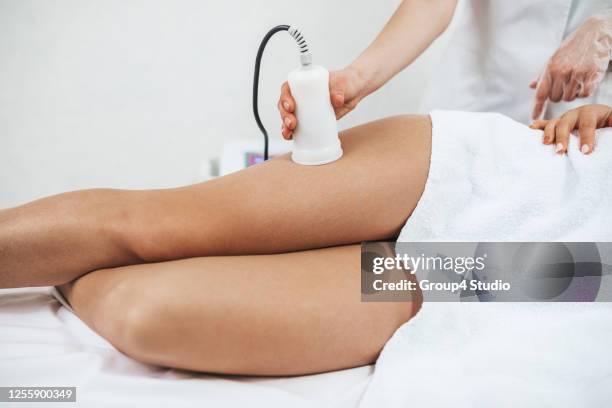 beautiful young adult woman at medical and beauty treatment - fat legs stock pictures, royalty-free photos & images
