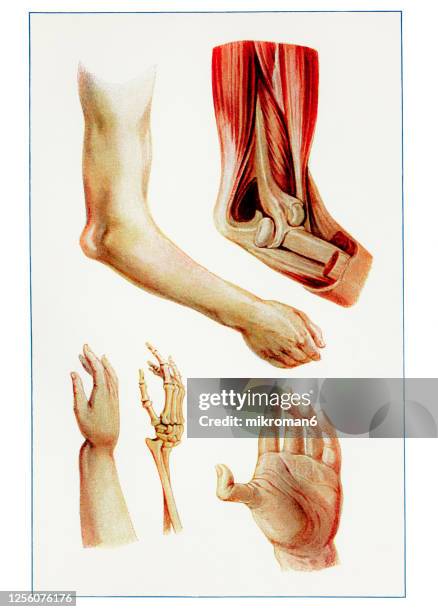 old engraved illustration of various kinds of dislocation of bones - human bone drawing stock pictures, royalty-free photos & images