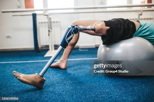 disabled man at physiotherapy center - amputee rehab stock pictures, royalty-free photos & images