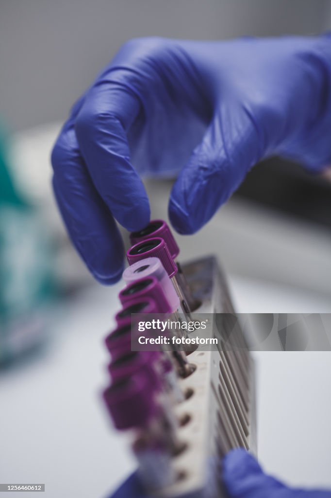 Obtaining Lab Sample A Day In The Laboratory Analyzing Medical Samples High-Res Stock Photo ...