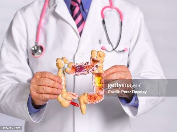 doctor holding common pathologies anatomical model - colorectal cancer stockfoto's en -beelden