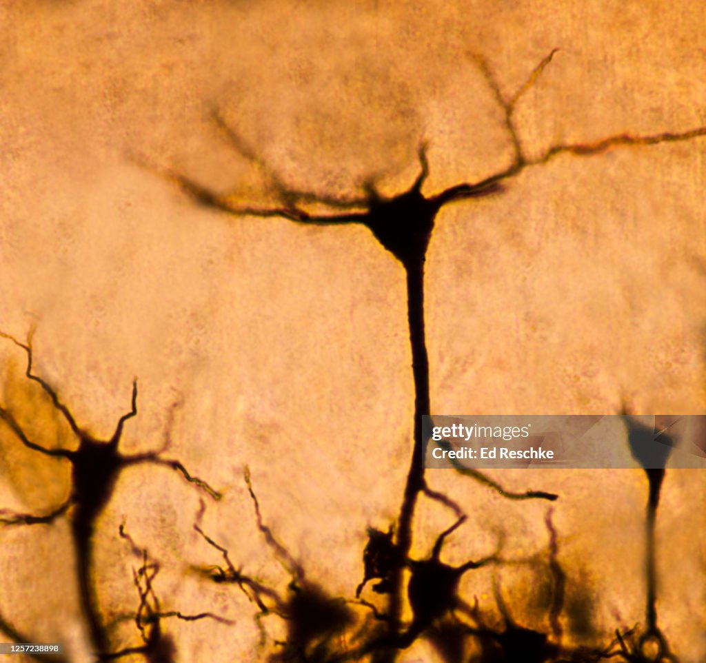 Pyramidal Cells Microscope Pyramidal Cell In The Cerebral Cortexapical Or Main Dendrite And ...
