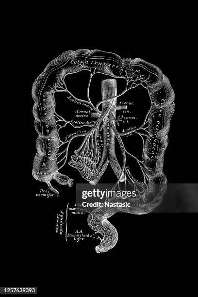 61 Mesenteric Artery Stock Photos, High-Res Pictures, and Images ...
